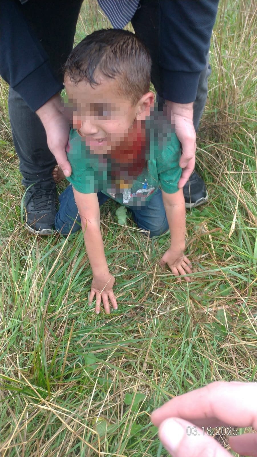 6 Yaşındaki Çocuk Sokak Köpeklerinin Saldırısına Uğradı: Kocaeli’de Yaşam Savaşı Veriyor