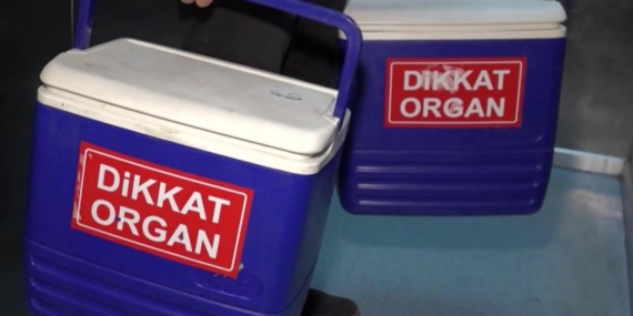 organ-nakli-1946247.jpg